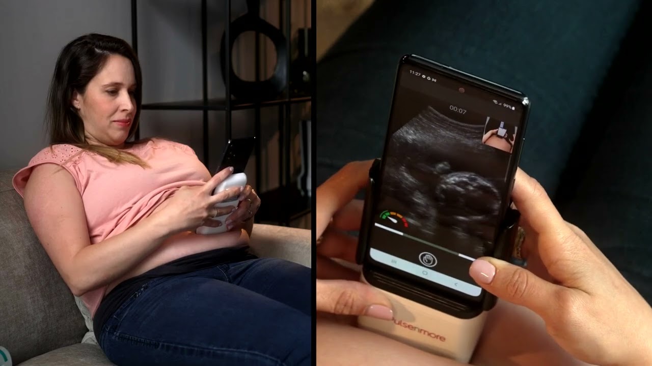 Pulsenmore's Home Ultrasound - App-Guided Mode