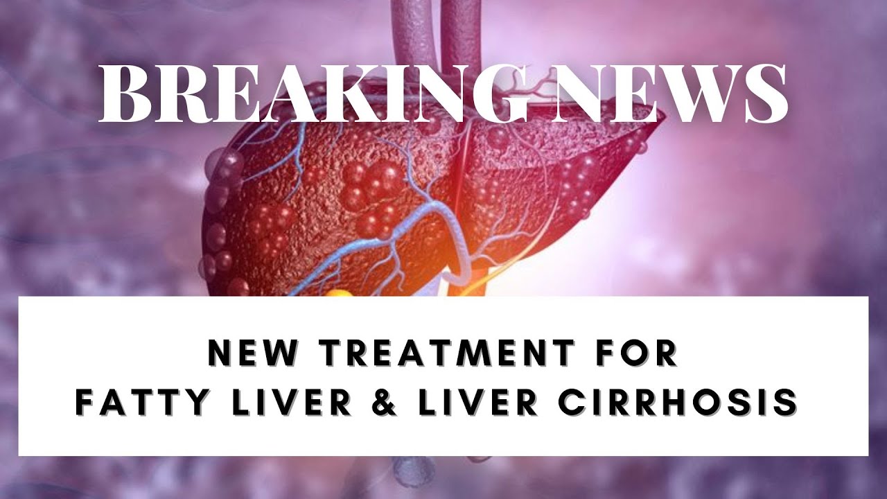 Liver Cirrhosis ? Stem Cells Patient Experience | Live Q&A Session with patient | Treatment