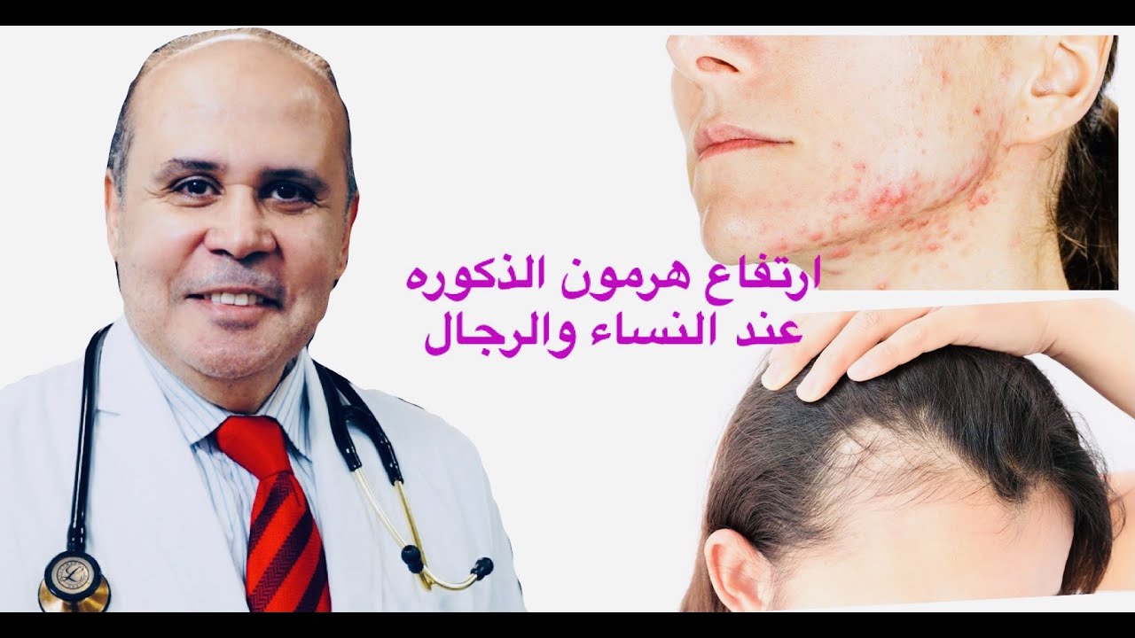 هذا ما يحدث في جسمك عندما يرتفع هرمون الذكوره .التيستوستيرون..معلومات لا تعرفها من قبل
