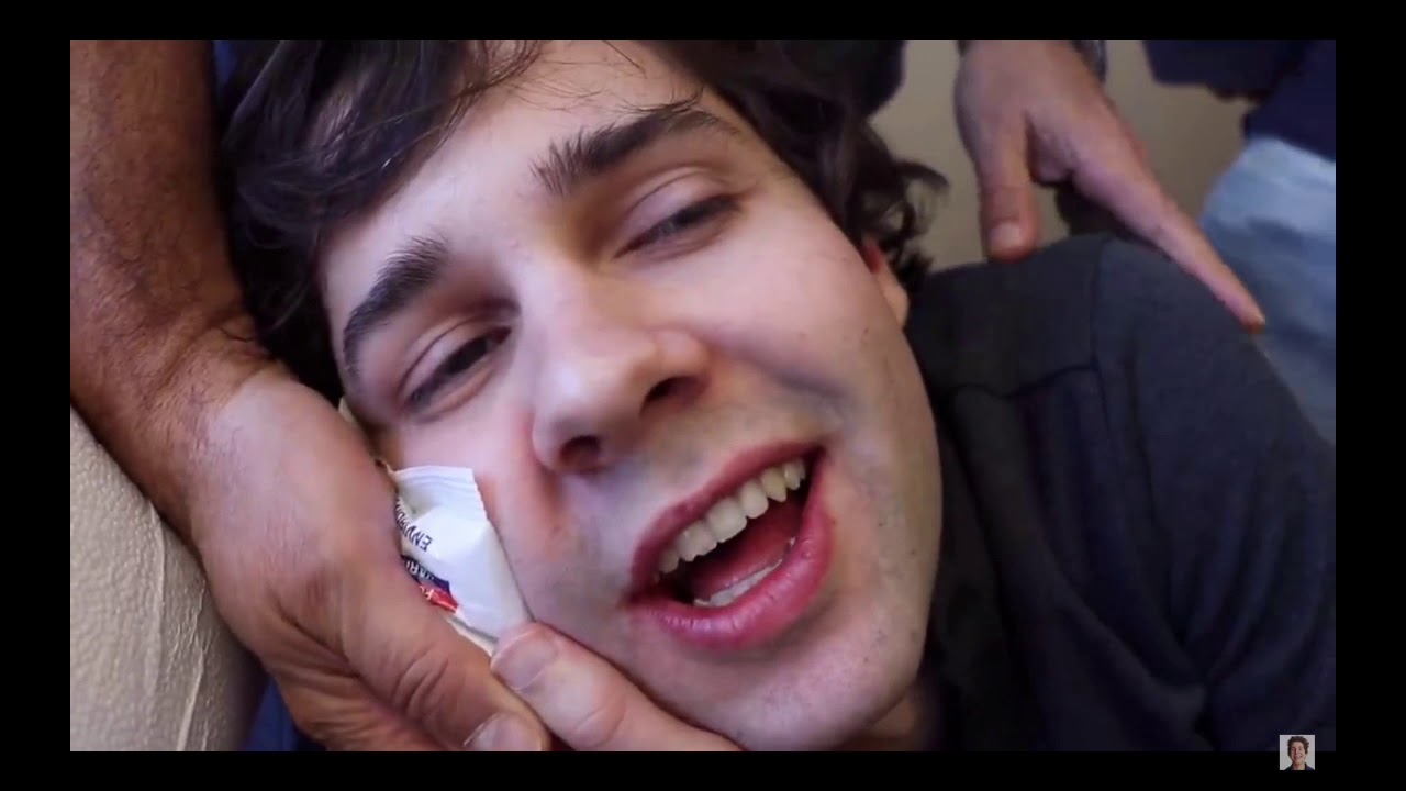 Must watch! David dobrik wisdom teeth removal full video on all vlog squad channels, Jason Nash