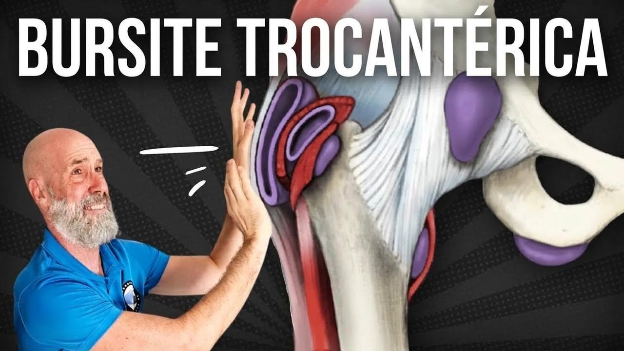 Exercícios para aliviar a dor da trocanterite