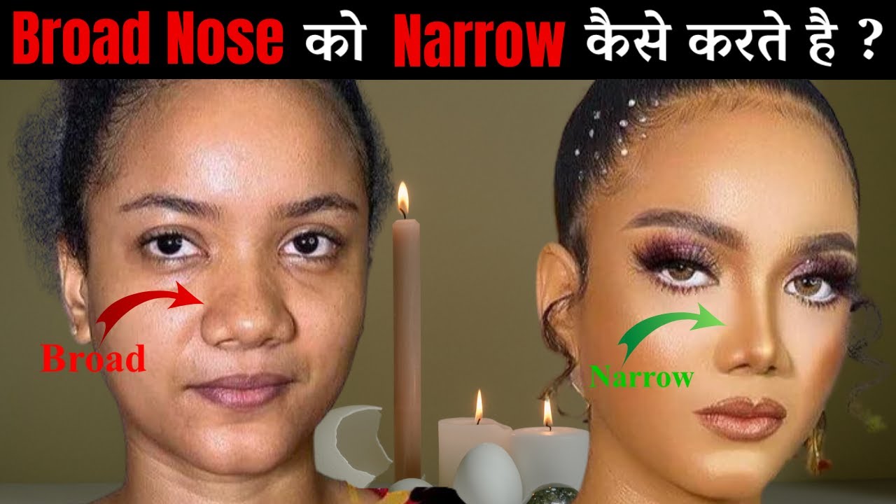 Broad Nose to Narrow Nose | Rhinoplasty | Dr Sunil Tanvar