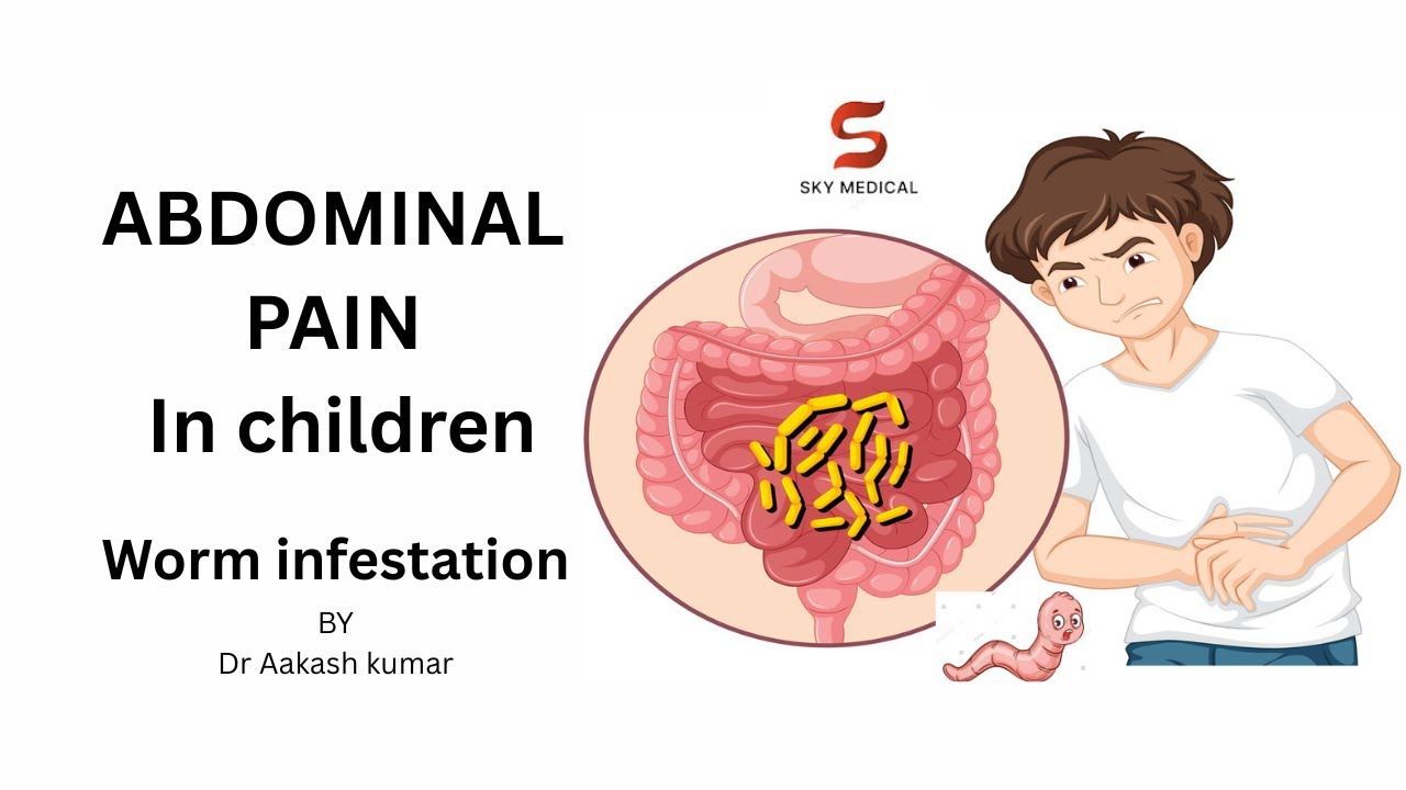 Abdominal pain & worm infection in children  #abdominalpain #intestinalworms #gastroenterology