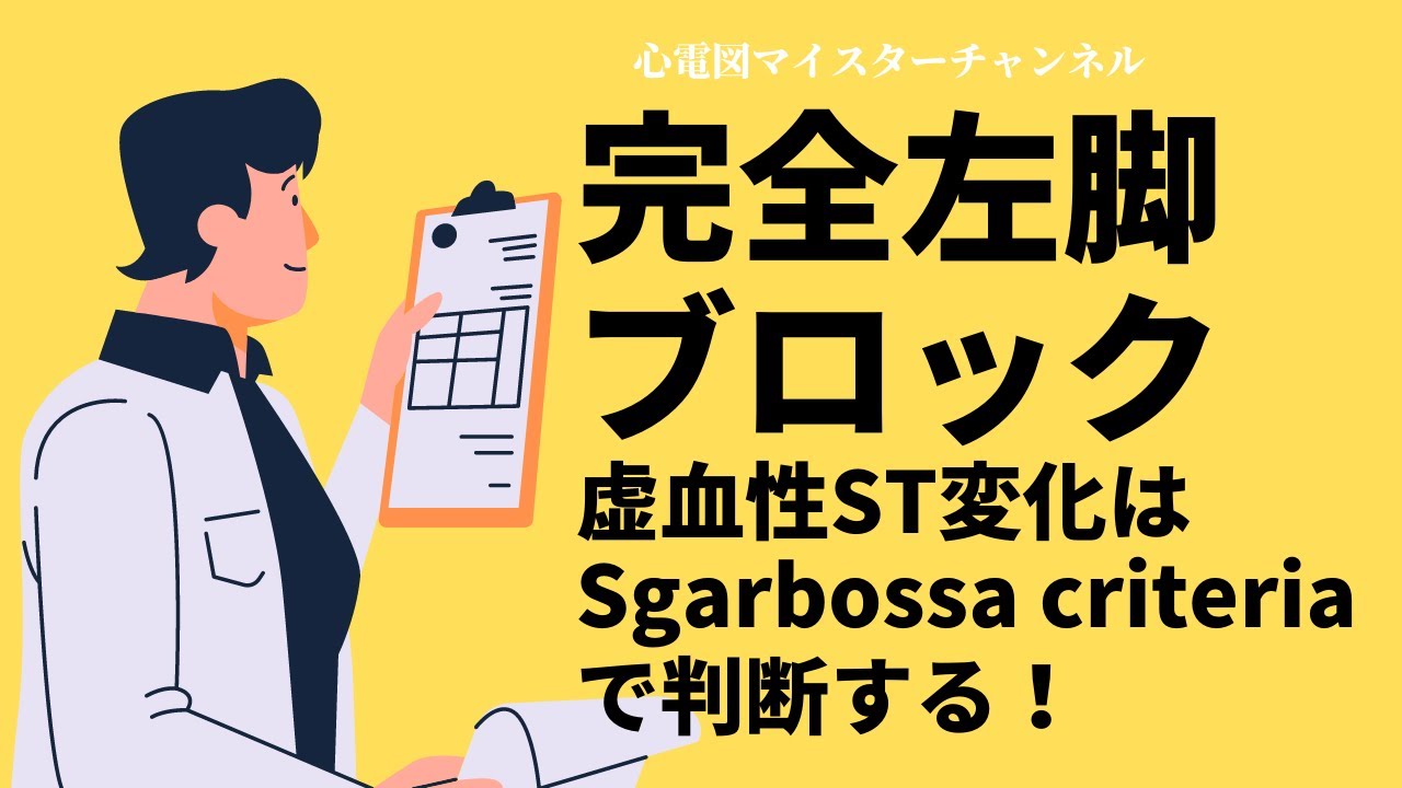 【心電図検定対策】Modified Sgarbossa criteriaをマスターする！