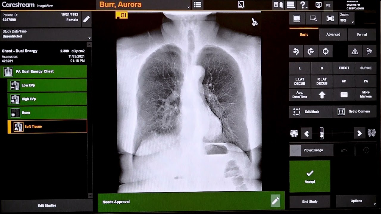 Dual Energy Acquisition and Configuration with ImageView Software