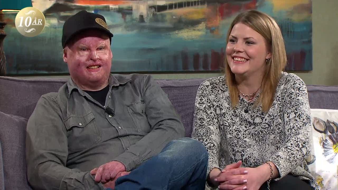 Fick frätande kalk och vattenånga över hela sig - överlevde med änglavakt - Malou Efter tio (TV4)