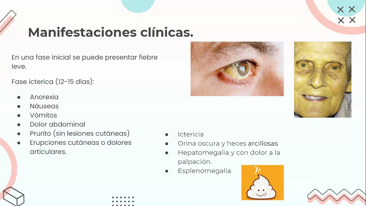 Hepatitis E