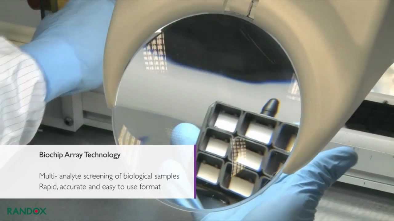 Randox | Revolutionizing Healthcare through Innovative Diagnostic Solutions