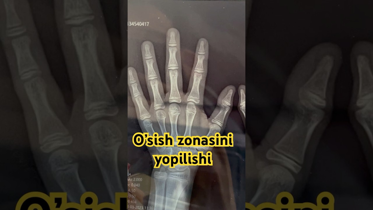 Ўсиш зонаси ва бўй пастлиги 