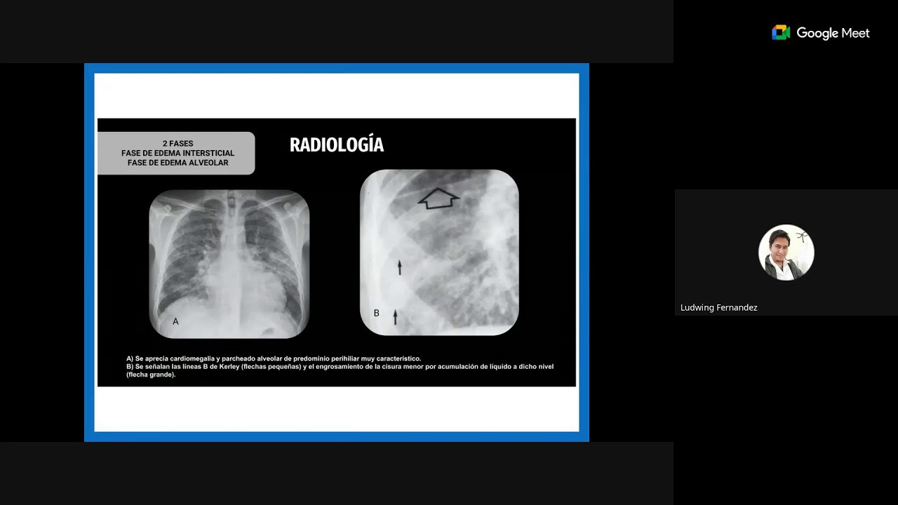 CURSO MODULAR:  Patologías Cardiovasculares y Respiratorias de Urgencia