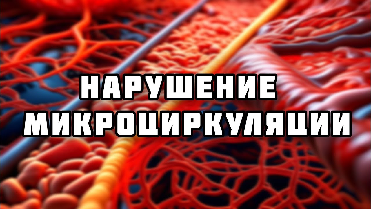 Нарушение микроциркуляции // Патофизиология (2 тема)