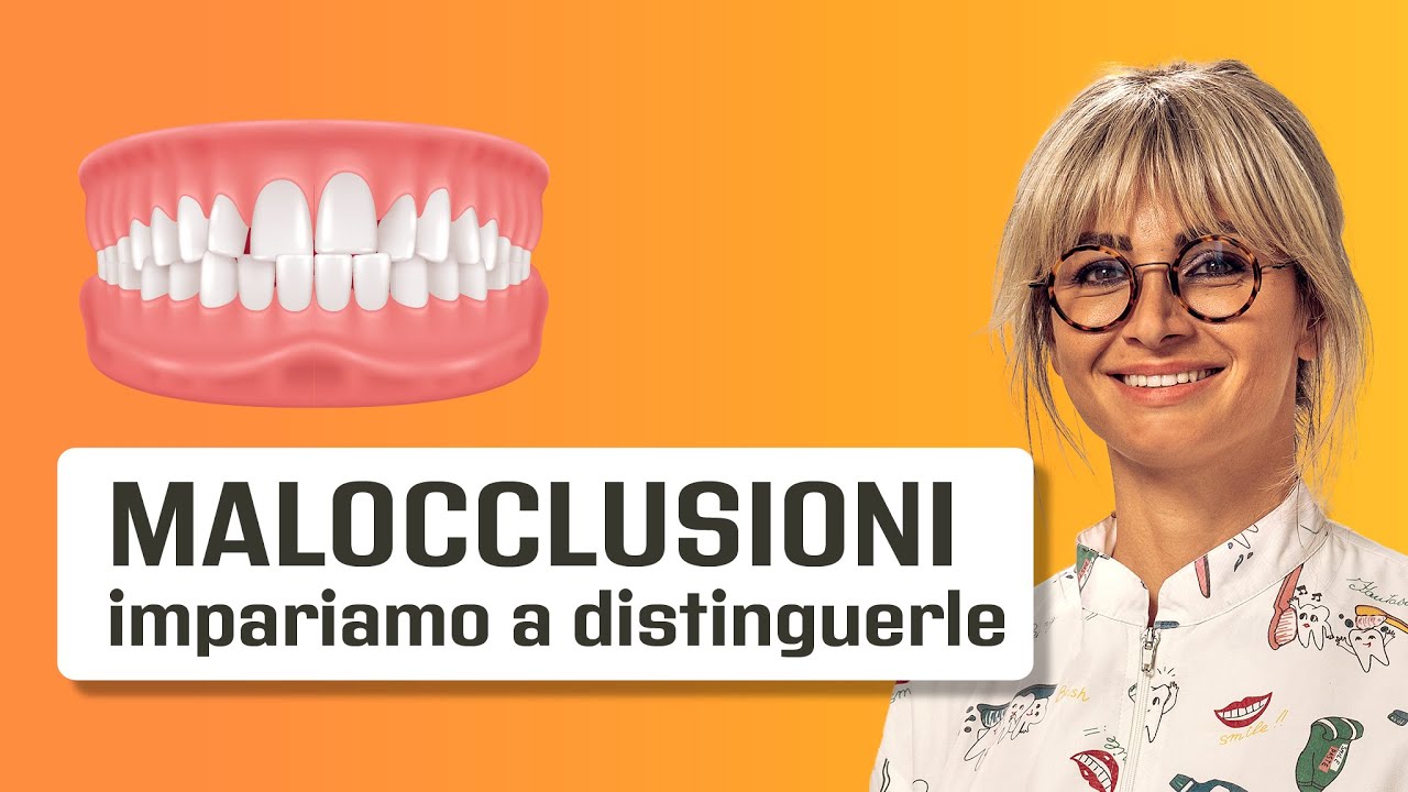 Malocclusioni - cosa sono e come si differenziano