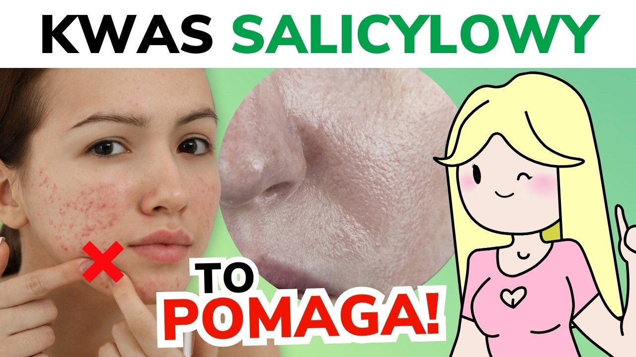 KWAS SALICYLOWY - do twarzy, na zaskórniki, na tłustą skórę! | W Krainie Składów