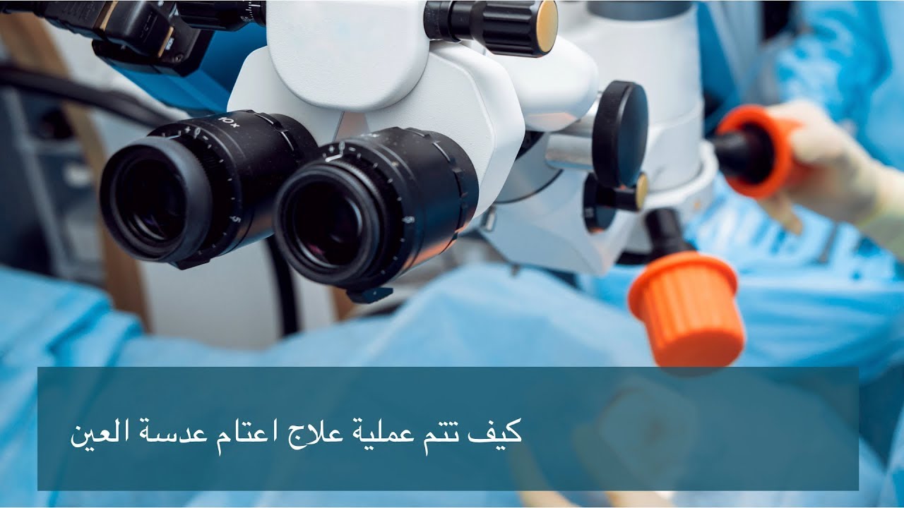 كيف تتم عملية علاج اعتام عدسة العين