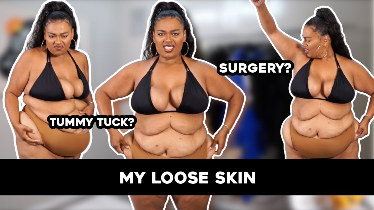My Plans for Loose Skin