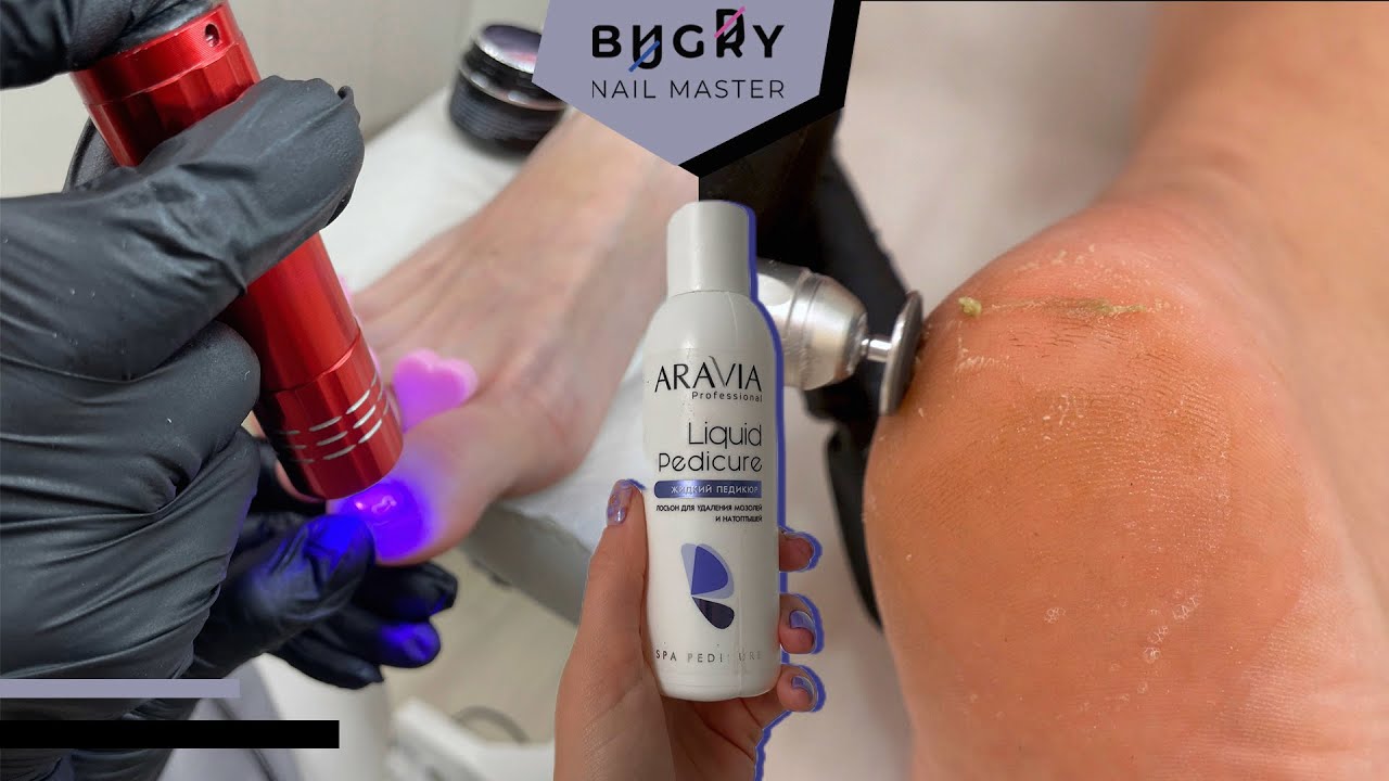 TOENAIL BITER?!? 😱 MY SECRETS TO A PERFECT PEDICURE