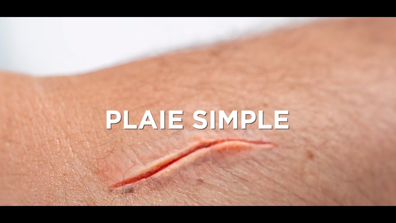 YLEA - Maquillage de Secourisme : Réaliser une plaie simple