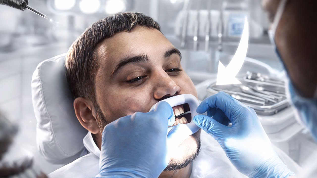 JE REFAIS MES DENTS EN TURQUIE POUR MA TRANSFORMATION !