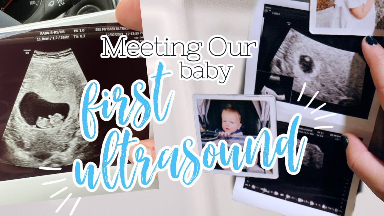 Our First Ultrasound After Two Miscarriages || How Many Babies + Cardiac Activity?