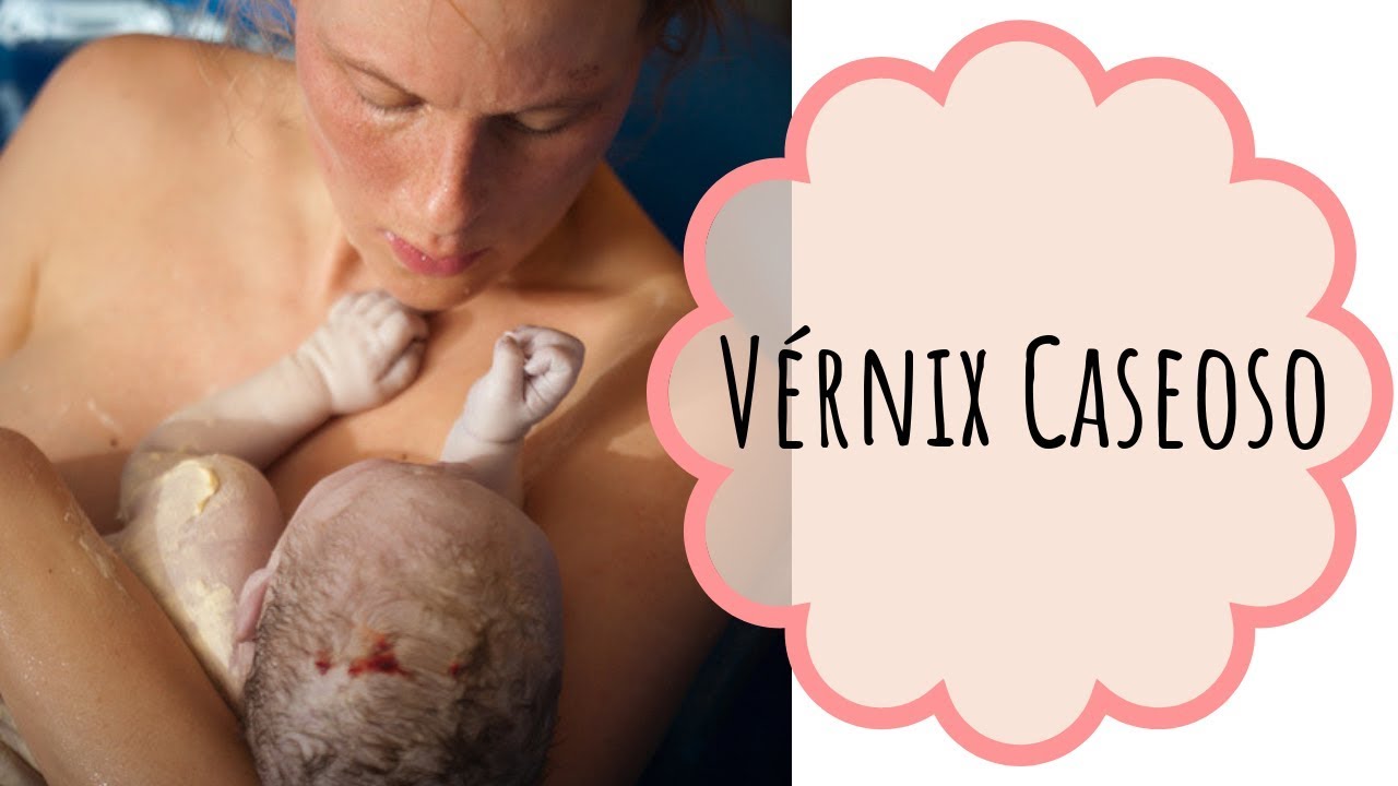 V&Eacute;RNIX CASEOSO&middot; &iquest;C&oacute;mo cuidar la piel del reci&eacute;n nacido?