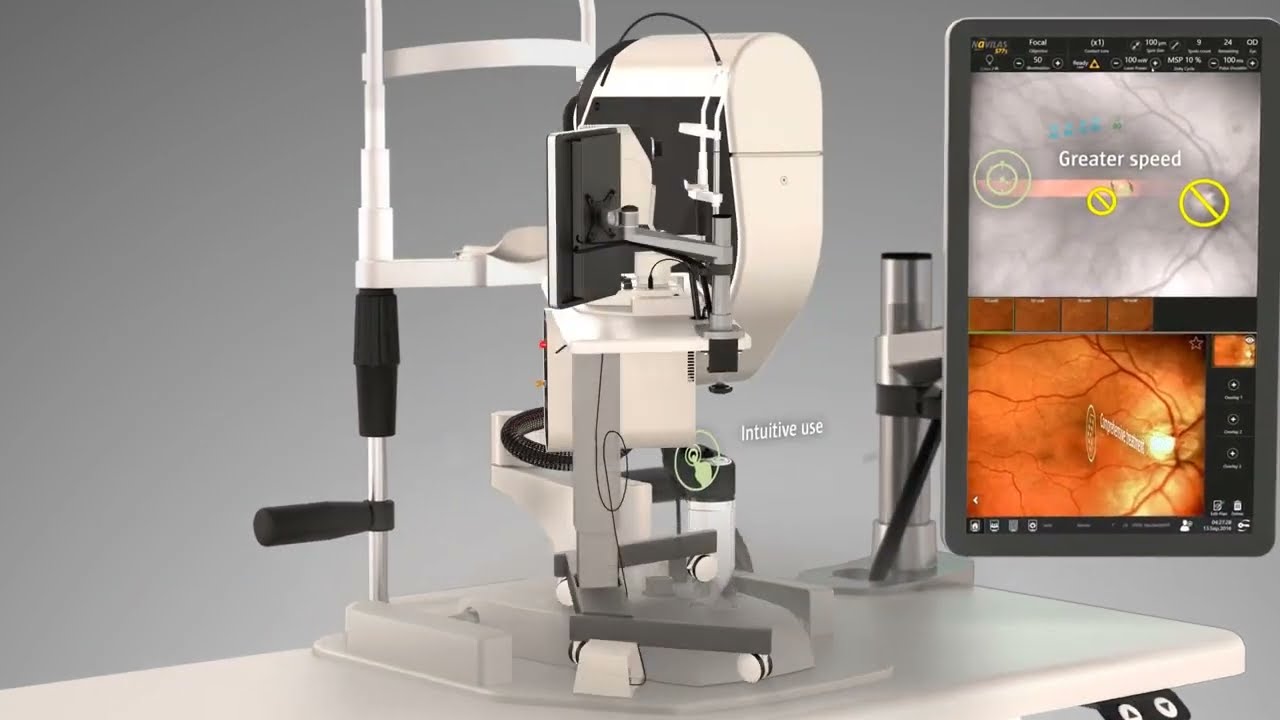 Navilas® Retinal Laser