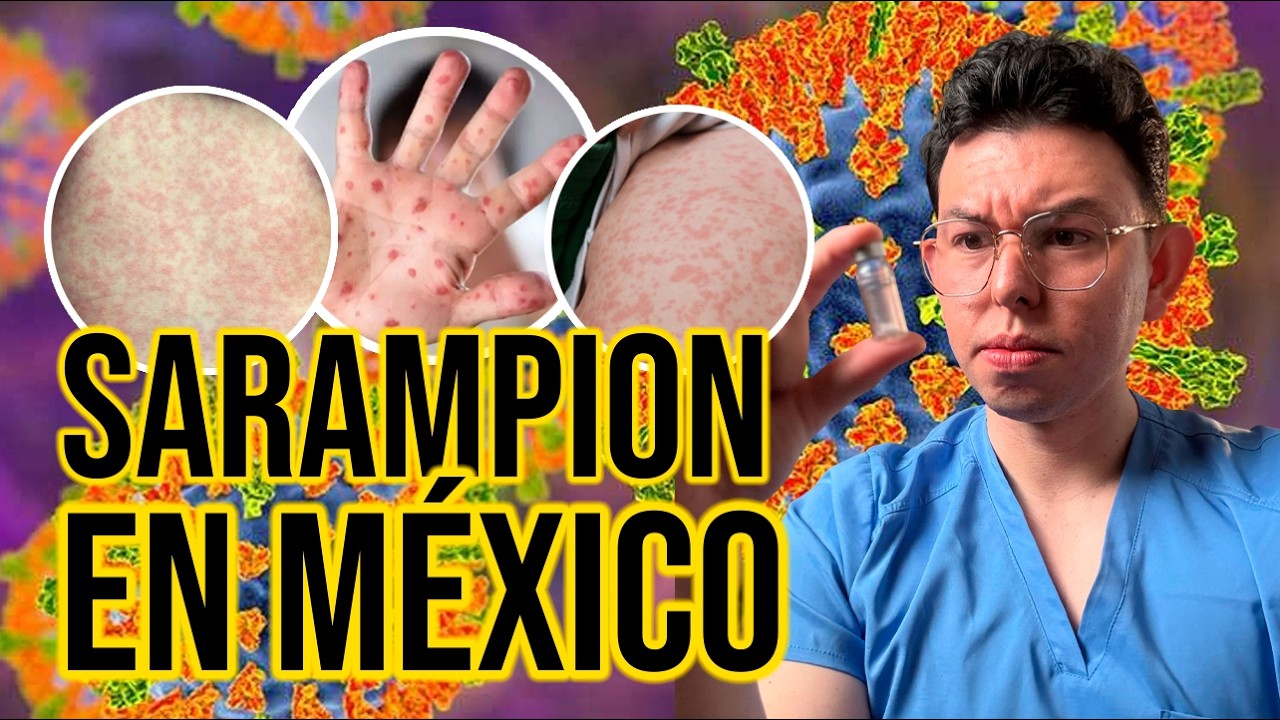 El PELIGRO del SARAMPIÓN y como PREVENIRLO