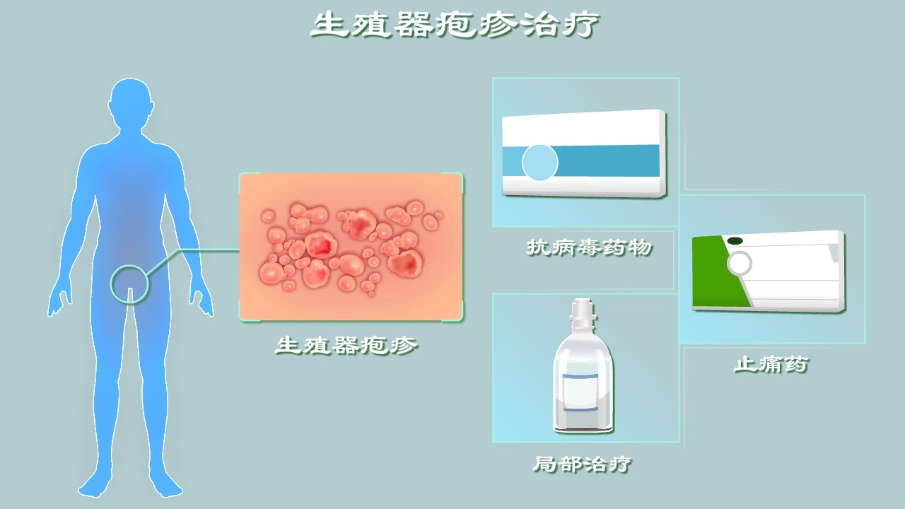 深读-生殖器疱疹4：生殖器疱疹还能啪吗？