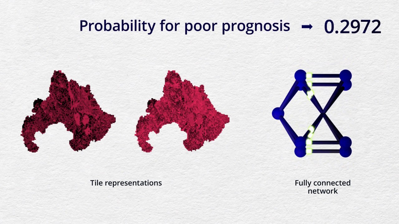 Deep learning for prediction of colorectal cancer outcome: a discovery and validation study