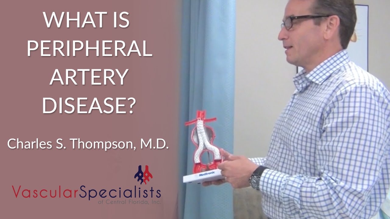 What Is Peripheral Arterial Disease?