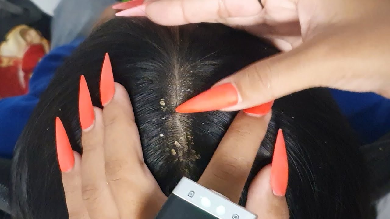 Ultimate Scalp Check for Sleep 😴 | Dandruff Removal & Gentle ASMR Nails #VF0163