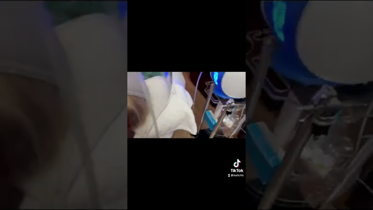 O2DERM Oxygen Facial w/Laser Lipo