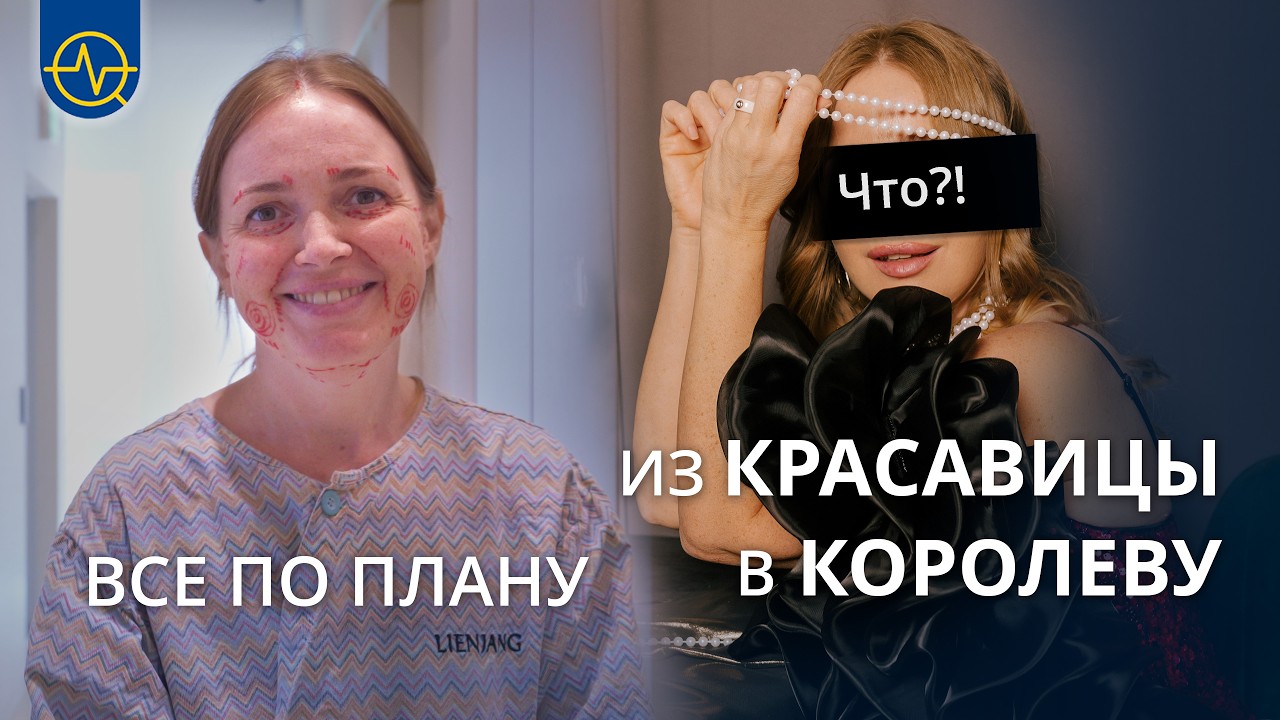 Мне повезло | Как я попала в проект “Я - Модель” и сделала операцию