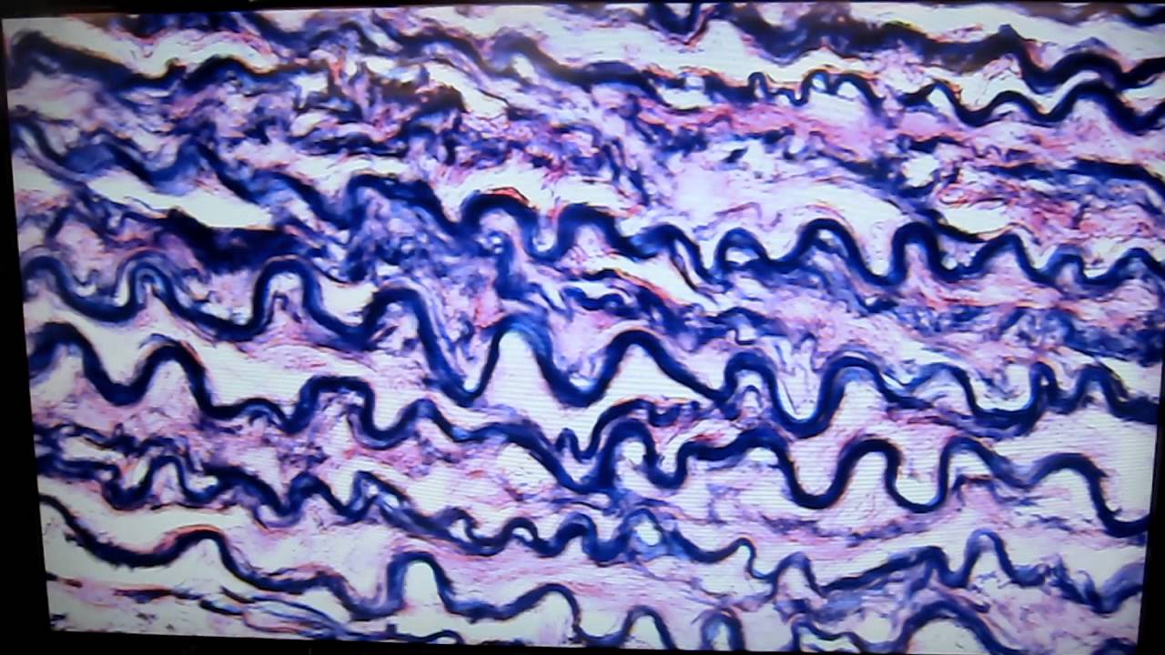 A&P1 Lab #3 elastic connective tissue