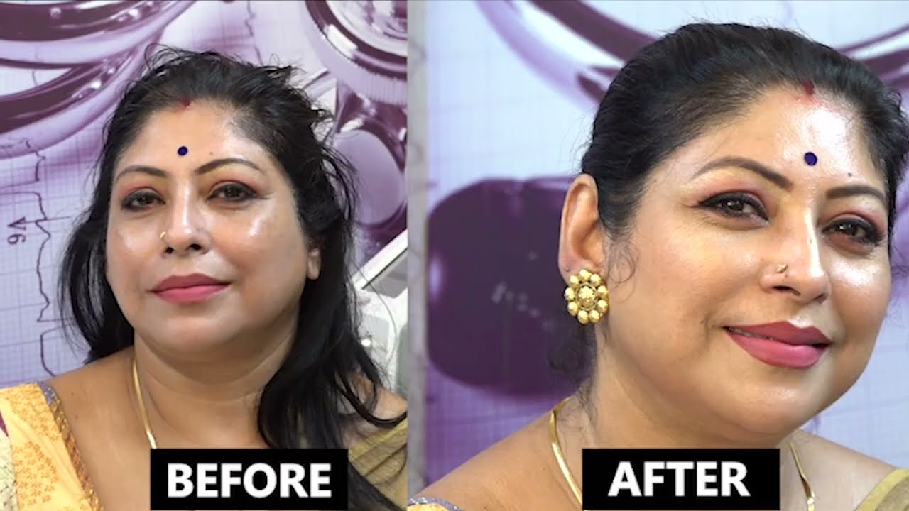 Carbon Peel Laser & GFC Hair Treatment | কার্বন পীল লেসার ও জিএফসি ট্রিটমেন্ট | Doctor Plus Kolkata
