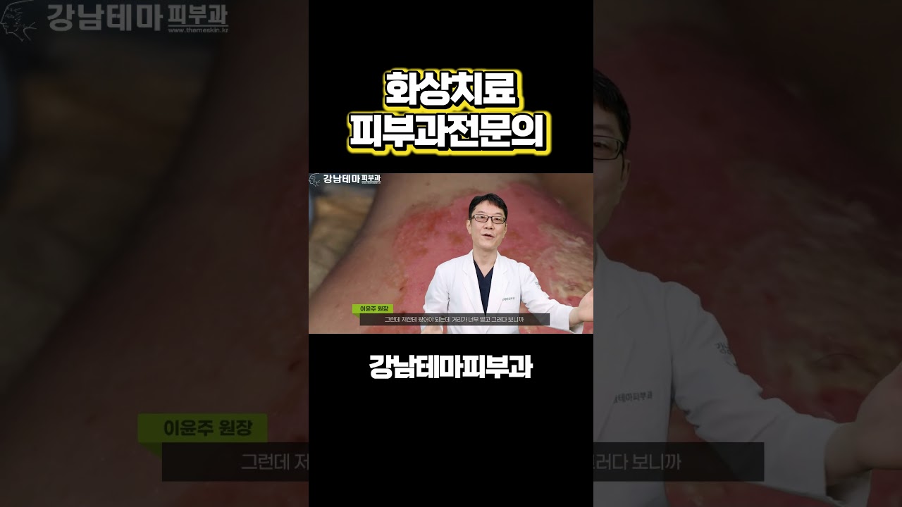 화상치료 이렇게 하세요.  피부과전문의가 알려드립니다 #화상치료