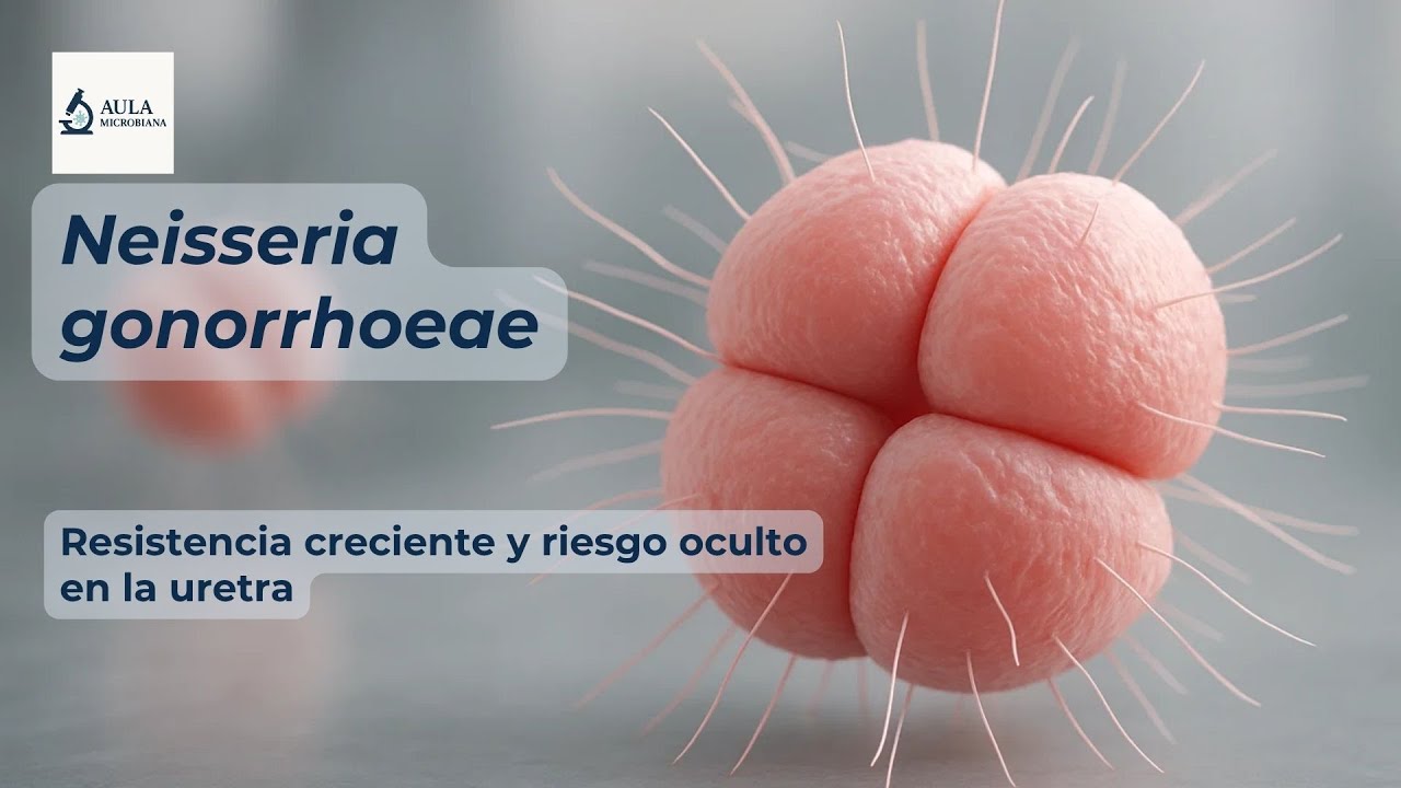 Neisseria gonorrhoeae (Gonococo)