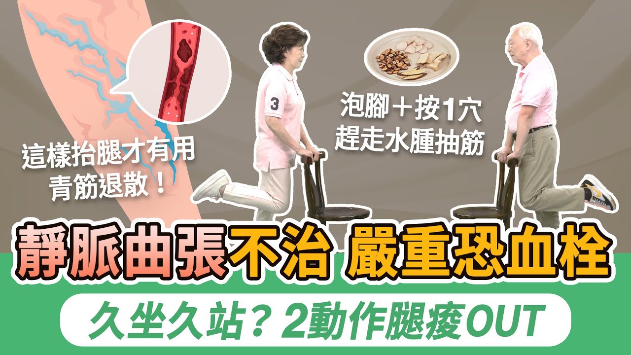 靜脈曲張嚴重恐肺栓塞奪命！40歲以上大多這2個原因。小腿水腫發癢當心血栓！4物泡腳＋按1穴，消水腫防抽筋。穿彈性襪抬腿有用？ 醫師示範2動作，防血管堵塞，緩解水腫痠脹｜胡乃文開講Dr.HU_269