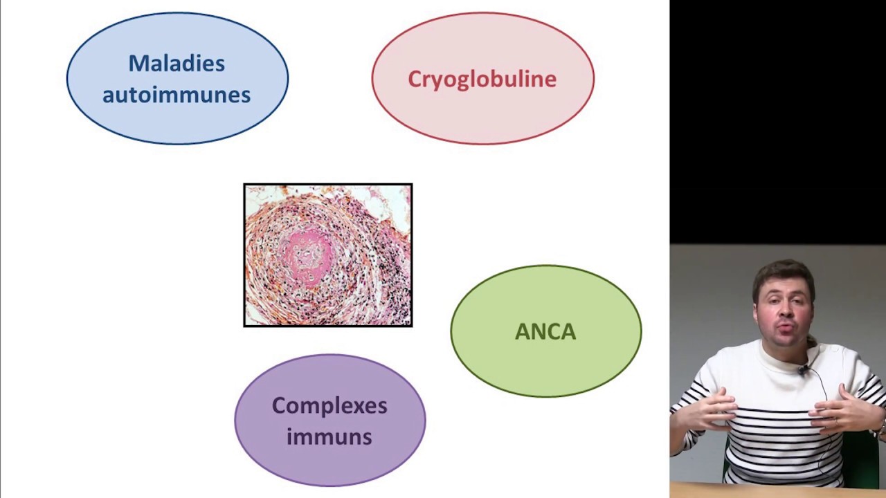 Vascularites des maladies auto-immunes
