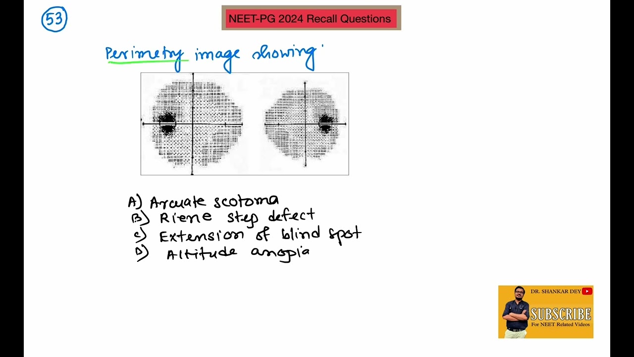 NEET-PG 2024 Recall || Questions no. 51 to 60 || Dr. Shankar Dey