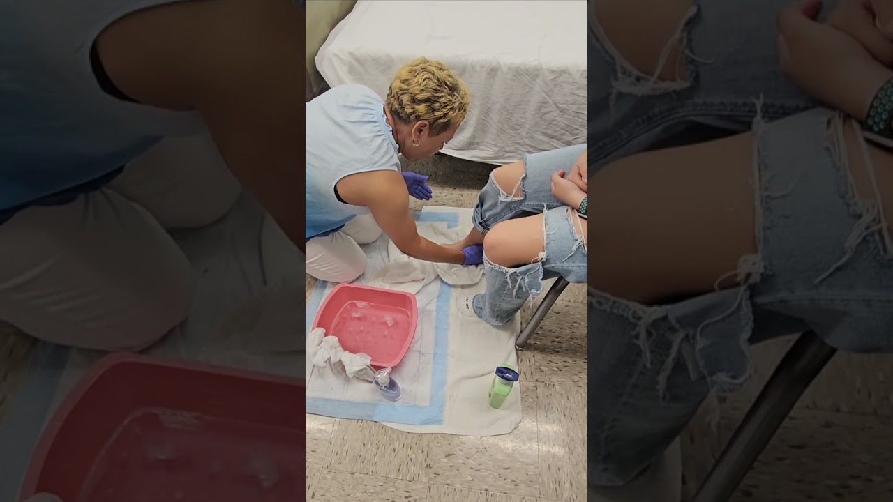 2025 PROMETRIC: PROVIDES FOOT CARE ON ONE FOOT