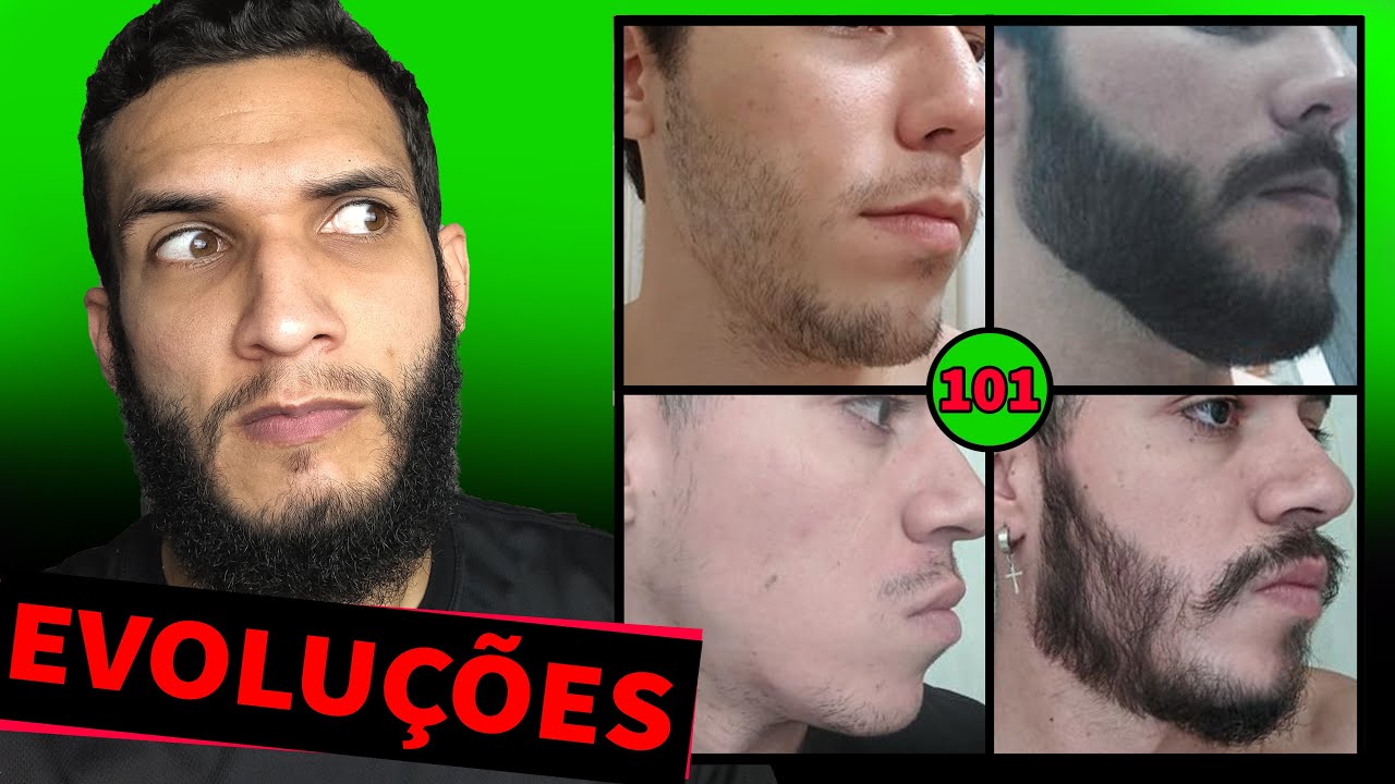 EVOLUÇÃO DOS INSCRITOS / MINOXIDIL #101 (antes e depois)