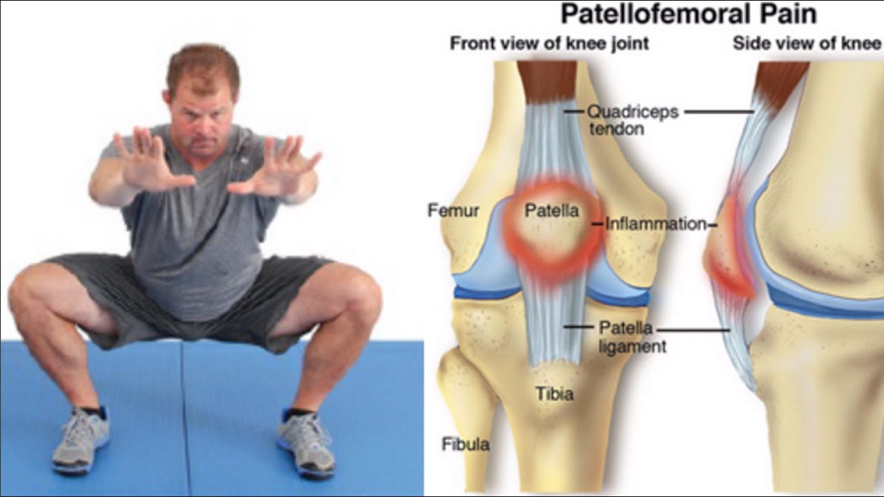Becoming a Brittle Leopard : Do Kelly Starrett's Teachings Cause Injury?