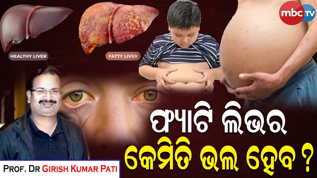 || DOCTOR ONLINE || ଫ୍ୟାଟି ଲିଭର କେମିତି ଭଲ ହେବ ? Dr Girish Kumar Pati || #fattyliver #health