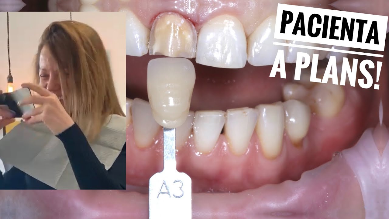 De ce NU Mai Fac O FATETA NICIODATA?! Pacienta A PLANS!