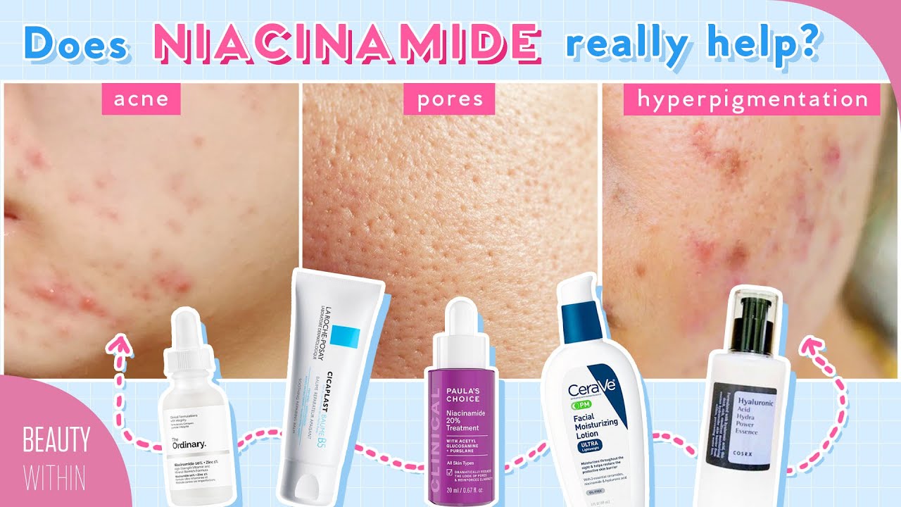 Niacinamide + Panthenol for Reducing Large Pores, Hyperpigmentation, Acne & More!