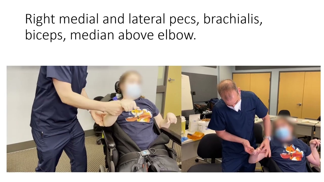 Restoring moving to adults with cerebral palsy