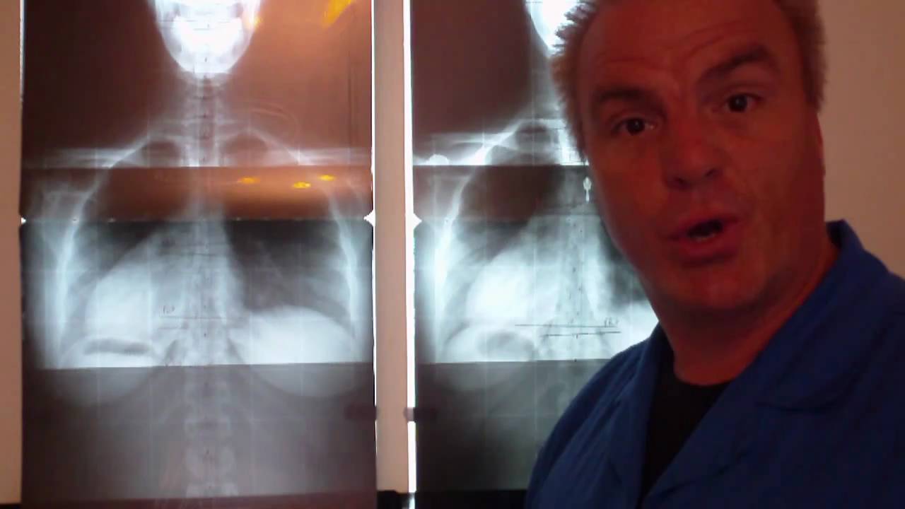 Round Rock Chiropractor / Pelvic X-ray Analysis