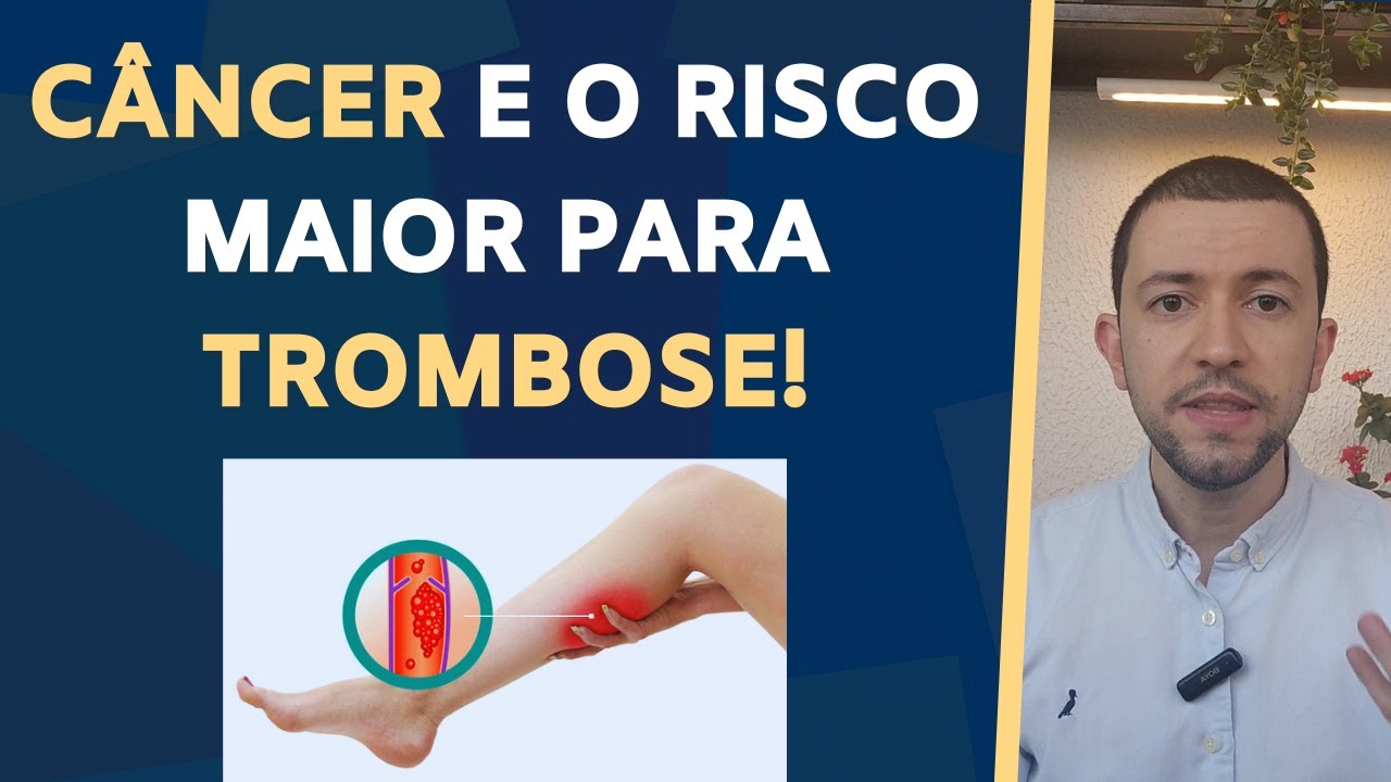 CÂNCER e o risco MAIOR para TROMBOSE VENOSA!