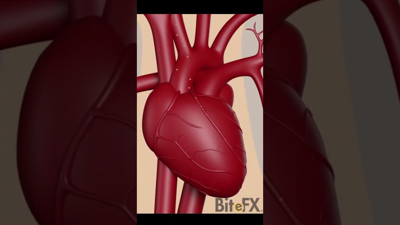 Bad Oral Health Causing Heart Attack