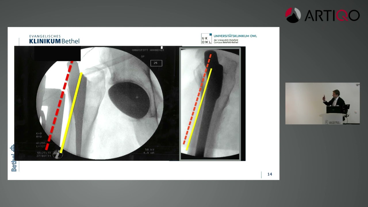 Warum Kurzsch&auml;fte? &ndash; Die aktuelle Datenlage